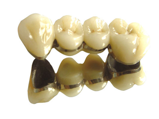 kupować Kolor zębów Kobalt Chrom Korona PFM Wysoki szlachetny PFM dentystyczny online manufacture