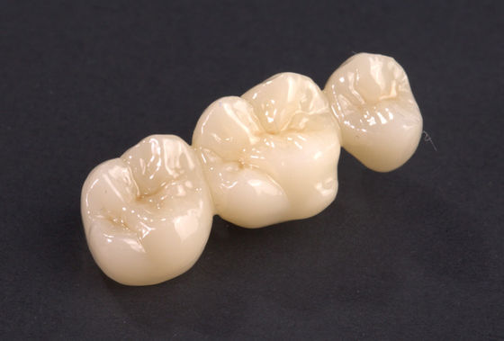kupować Precyzyjne dopasowanie pełnego konturu Zirconia most naturalny Zirconia most koronowy Wysoka wytrzymałość online manufacture