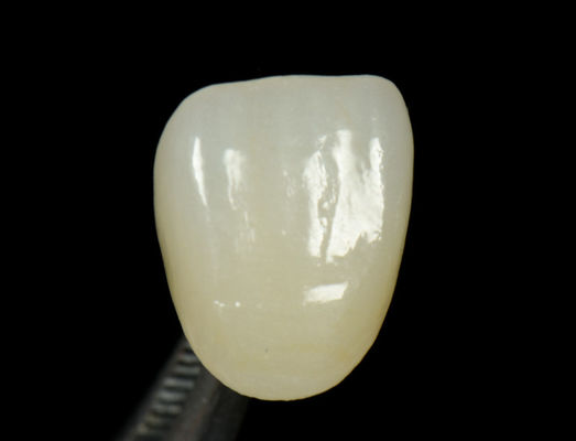 kupować Dostosowywalny Emax Press Crown Fast And High Esthetics Dental Inlay Onlay online manufacture