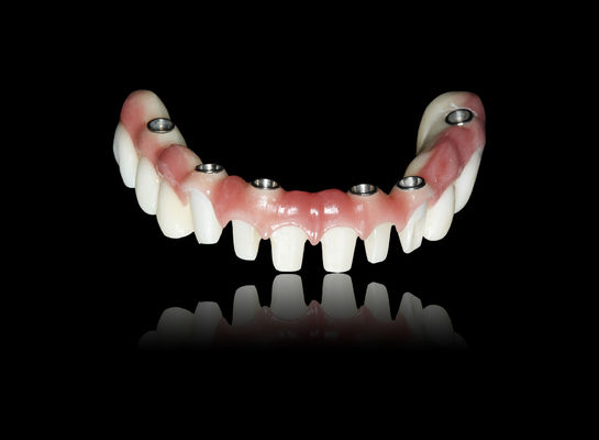 kupować Wszystkie na X Implant Zirkonia most Implant Korona most Naturalny wygląd online manufacture