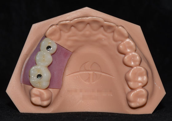kupować Implant Porcelana stopiona z cyrkonia Implant Crown Bridge Wysoce estetyczny online manufacture