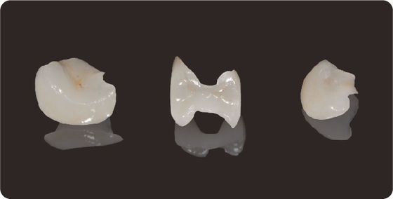 kupować Dokładność zębów Inlays i Onlays Litium Disilicate Milling Onlay Veneer online manufacture