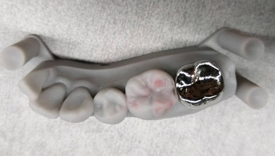 kupować Implant królewski z metalu niecennego PFM Królewski i most profesjonalny online manufacture