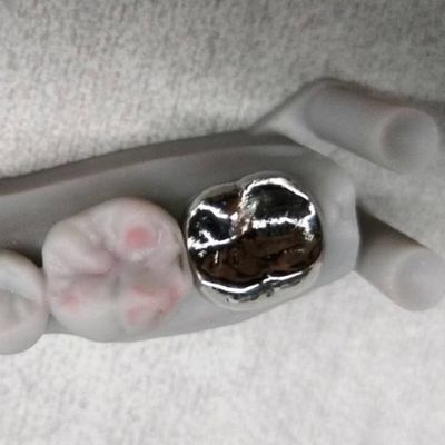 kupować Całkowicie metalowa korona i most Wysokiej dokładności Srebrna korona tymczasowa online manufacture