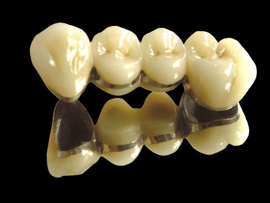 kupować Implant mostek z metali szlachetnych mostek korony odporny na zużycie online manufacture