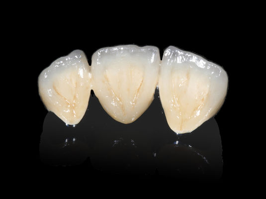 kupować Implant Dental PFM Bridge Non Precious CAD CAM PFM Crown online manufacture
