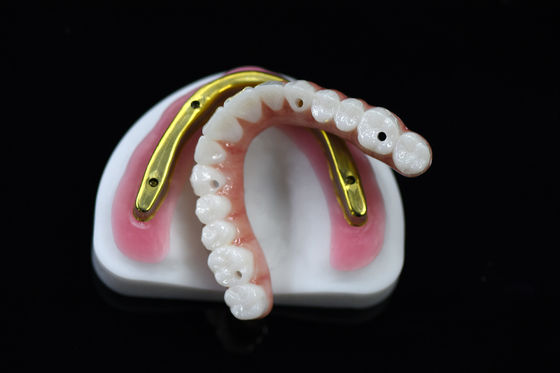 kupować Zastosowalny most z cyrkonii zębowej nad sztabką do implantów online manufacture