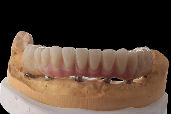 kupować Zastosowanie hybrydowych implantów dentystycznych Hybrydowe protezy z tytułem online manufacture