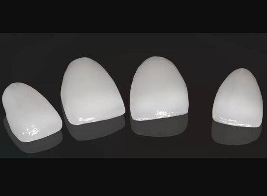 kupować Wysoka estetyka kompozytowa korona Onlay Veneer Dostosowywalny rozmiar online manufacture