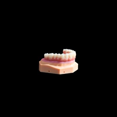 kupować Implant koronowy o podstawie Ti Korona tytanowa / mostek złożony online manufacture