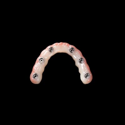 kupować Implantacja zębów sztucznych o natychmiastowym obciążeniu online manufacture
