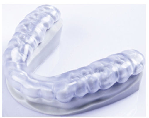 Przejrzystość zębów z miękką szliną 3D Drukowane urządzenie ortodontyczne