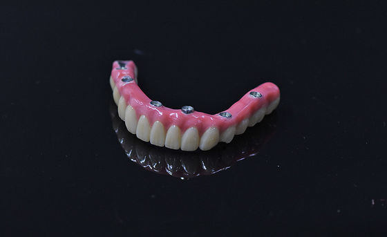 Implantacja zębów sztucznych o natychmiastowym obciążeniu