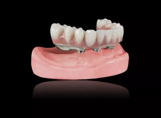 Implant Tytułowy Pręty Wyjmowalne Pręty Tytułowy Stopy Pręty Przekraczające Pręty